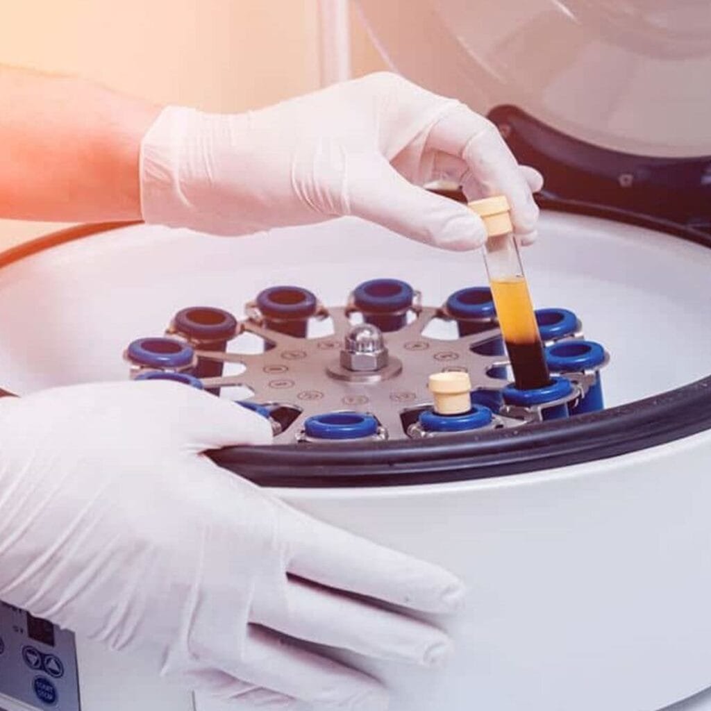 BMC (Bone Marrow Concentrate Therapy) 2 Body's Healing Potential with BMC Therapy at Specialty Pain Center