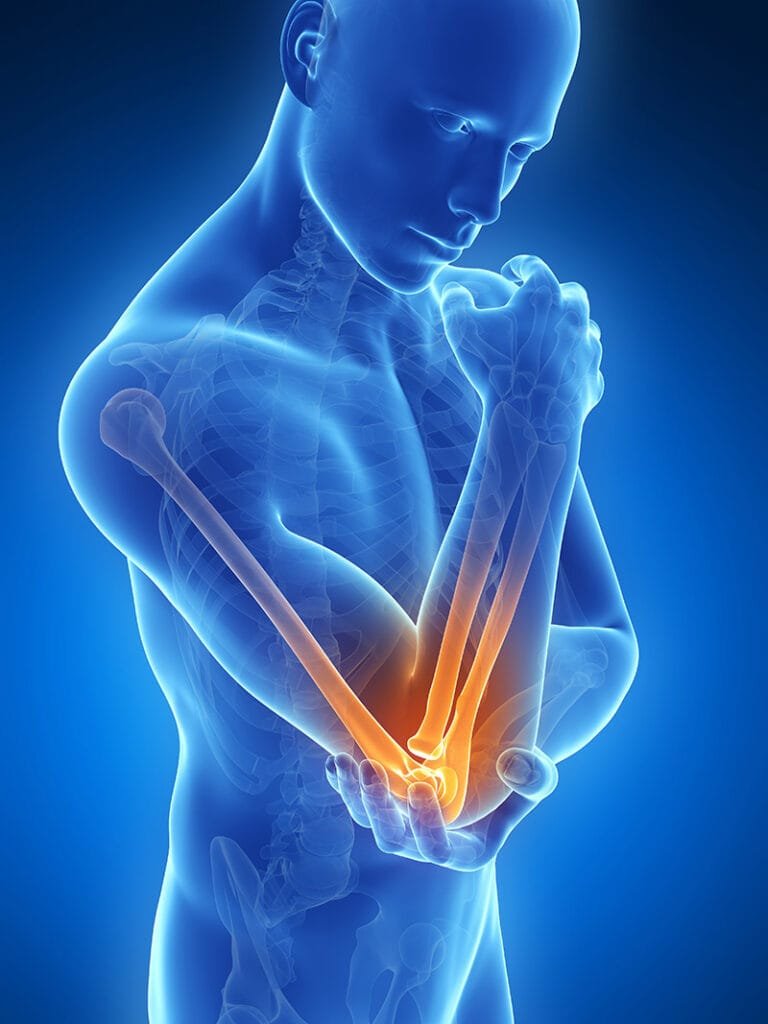 Relieve Elbow Pain with Expert Care