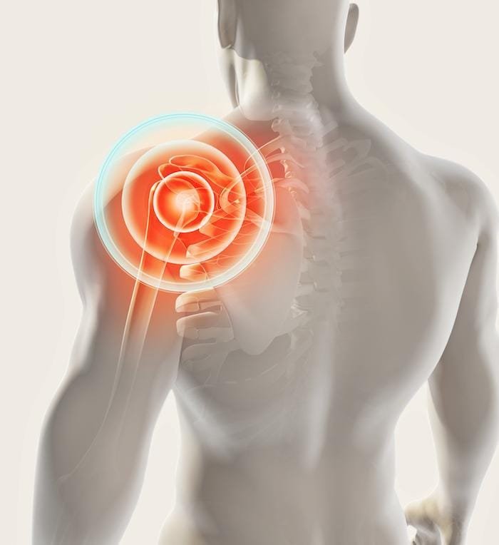 Relief for Shoulder Pain: Expert Solutions